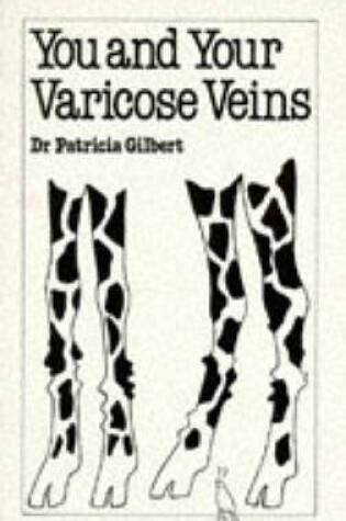 Cover of You and Your Varicose Veins