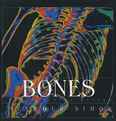 Book cover for Bones