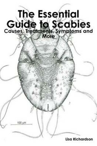 Cover of The Essential Guide to Scabies: Causes, Treatments, Symptoms and More