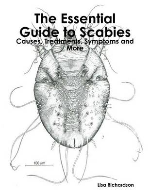 Book cover for The Essential Guide to Scabies: Causes, Treatments, Symptoms and More