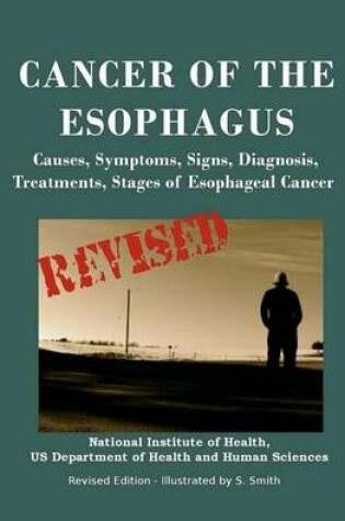 Cover of Cancer of the Esophagus