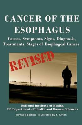 Book cover for Cancer of the Esophagus