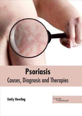 Book cover for Psoriasis: Causes, Diagnosis and Therapies