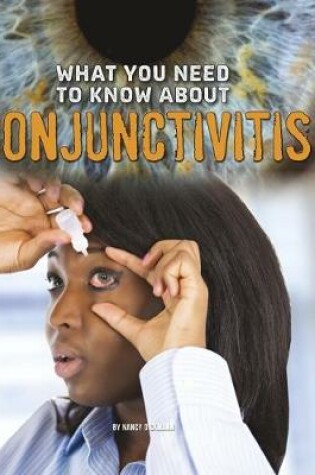 Cover of What You Need to Know about Conjunctivitis