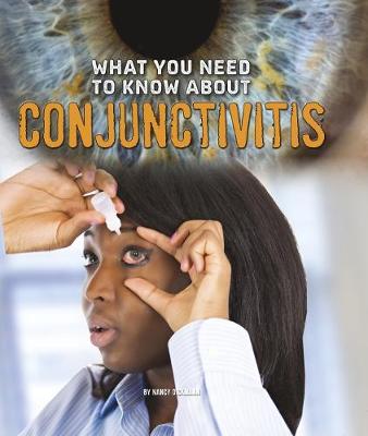 Cover of What You Need to Know about Conjunctivitis