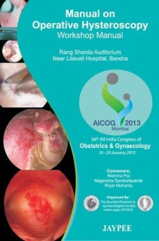 Cover of Manual on Operative Hysteroscopy: Workshop Manual