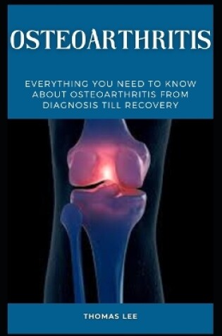 Cover of Osteoarthritis