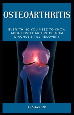 Book cover for Osteoarthritis