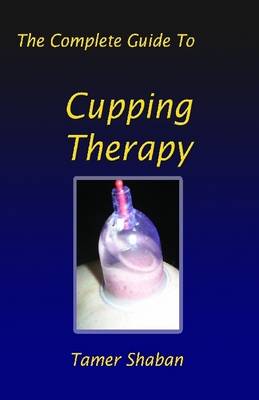 Book cover for The Complete Guide to Cupping Therapy: The Complete Guide To