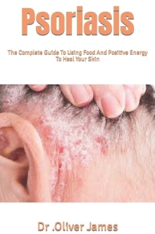 Cover of Psoriasis