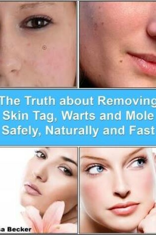 Cover of The Truth About Removing Skin Tag, Warts and Mole Safely, Naturally and Fast