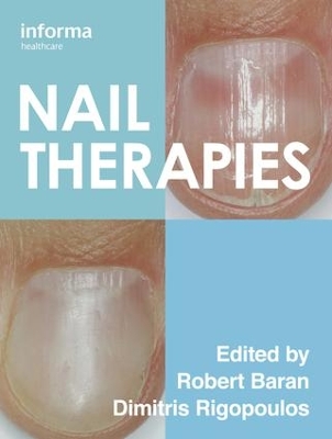 Cover of Nail Therapies