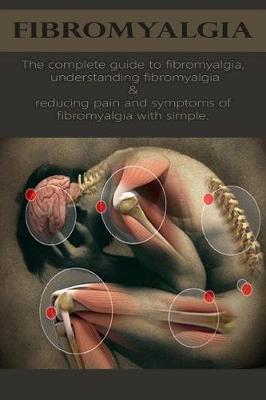 Book cover for Fibromyalgia