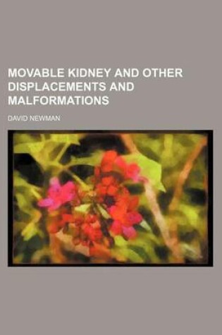 Cover of Movable Kidney and Other Displacements and Malformations