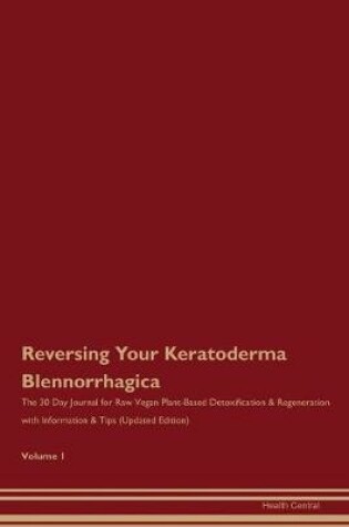 Cover of Reversing Your Keratoderma Blennorrhagica