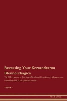 Book cover for Reversing Your Keratoderma Blennorrhagica