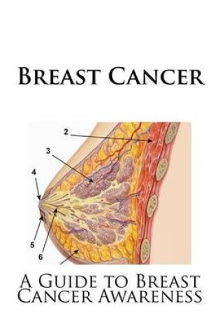 Cover of Breast Cancer