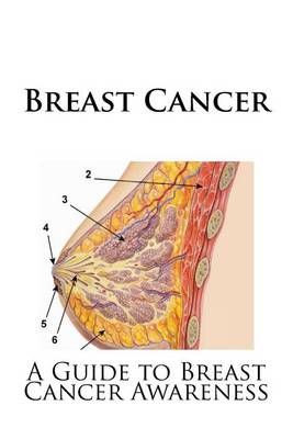 Book cover for Breast Cancer