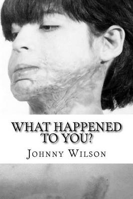 Book cover for What Happened to You?