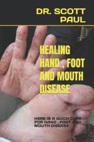 Cover of Healing Hand , Foot and Mouth Disease