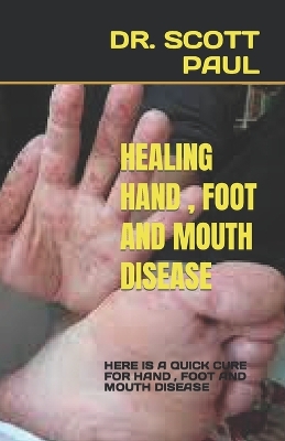 Book cover for Healing Hand , Foot and Mouth Disease