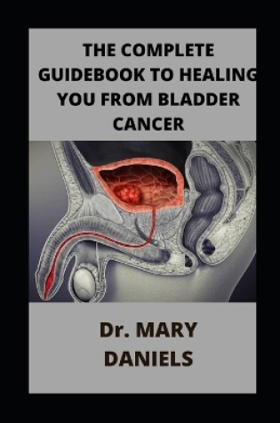 Cover of The Complete Guidebook To Healing You From Bladder Cancer