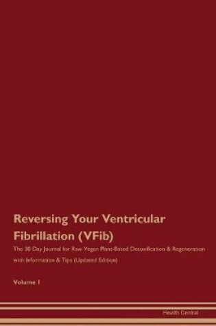 Cover of Reversing Your Ventricular Fibrillation (VFib)