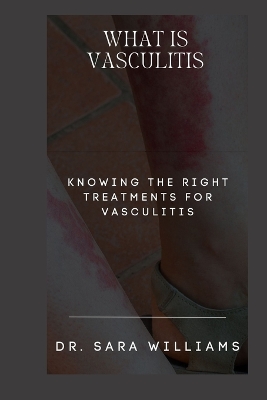 Book cover for What Is Vasculitis