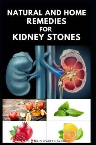 Cover of Natural and Home Remedies for Kidney Stones