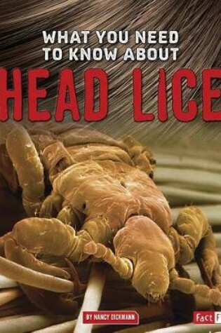 Cover of What You Need to Know About Head Lice (Focus on Health)