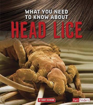 Book cover for What You Need to Know About Head Lice (Focus on Health)