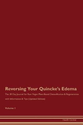 Cover of Reversing Your Quincke's Edema