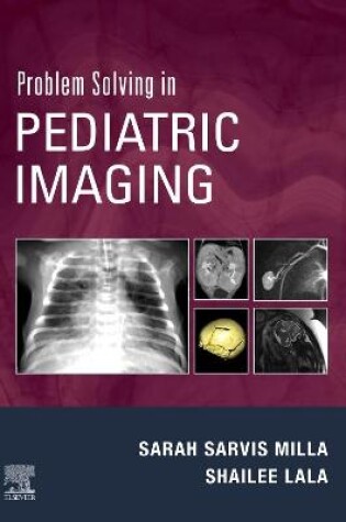 Cover of Problem Solving in Pediatric Imaging E-Book