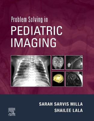 Cover of Problem Solving in Pediatric Imaging E-Book