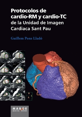 Book cover for Protocolos de cardio-RM y cardio-TC de la Unidad de Imagen Cardiaca Sant Pau