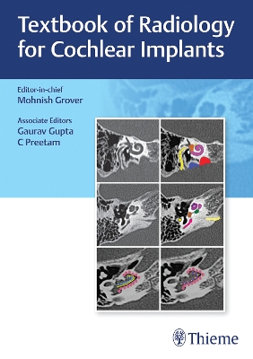 Cover of Textbook of Radiology for Cochlear Implants