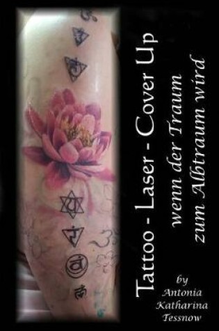 Cover of Tattoo - Laser - Cover Up