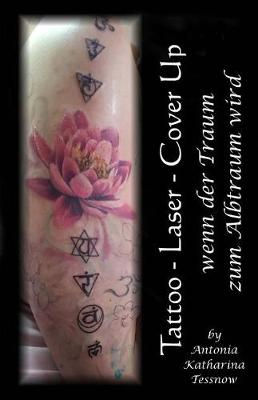 Book cover for Tattoo - Laser - Cover Up