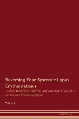 Book cover for Reversing Your Systemic Lupus Erythematosus