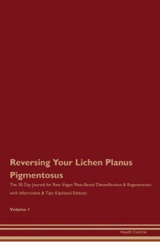 Cover of Reversing Your Lichen Planus Pigmentosus