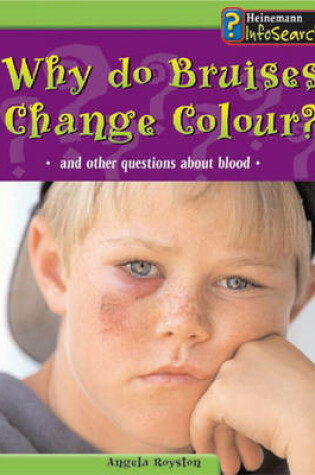 Cover of Body Matters Why do bruises change colour Paperback