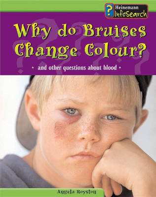 Cover of Body Matters Why do bruises change colour Paperback