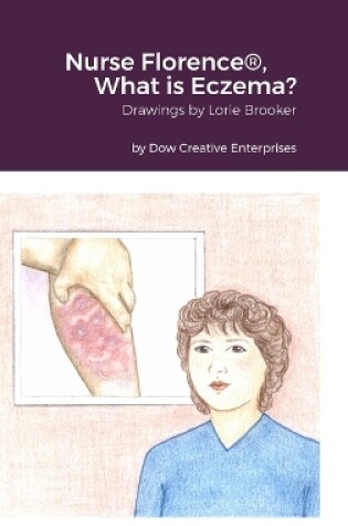 Cover of Nurse Florence(R), What is Eczema?