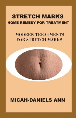 Book cover for Stretch Marks Home Remedy for Treatment
