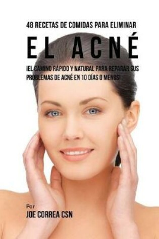 Cover of 48 Recetas De Comidas Para Eliminar El Acne