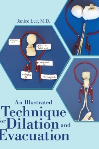 Cover of An Illustrated Technique for Dilation and Evacuation