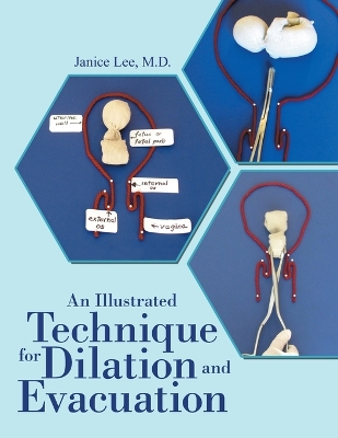 Book cover for An Illustrated Technique for Dilation and Evacuation