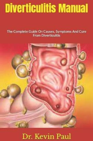 Cover of Diverticulitis Manual