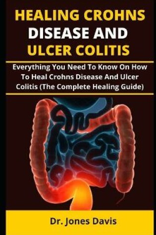 Cover of Healing Crohns Disease and Ulcer Colitis