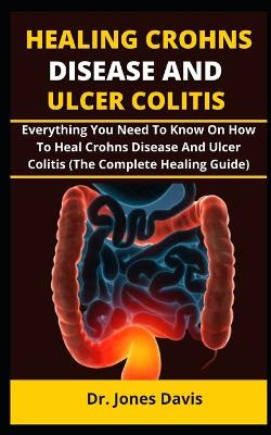 Cover of Healing Crohns Disease and Ulcer Colitis